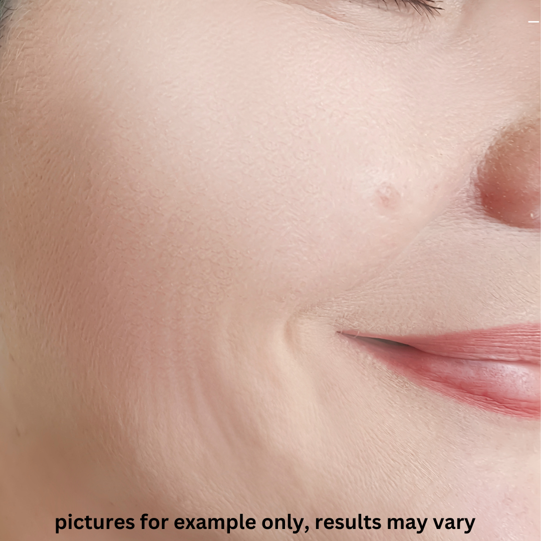 Firmness & Texture Focus — After