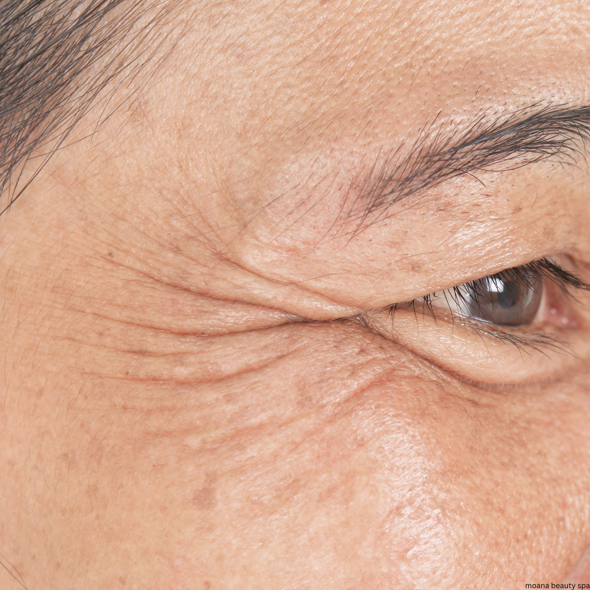 Moana Signature Facial — Before